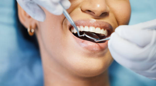 Best Affordable Emergency Dental Care  in Fredericktown, OH