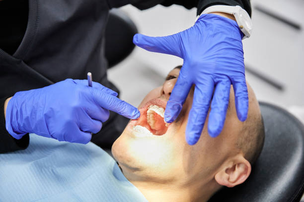 Best Chipped Tooth Repair Near Me  in Fredericktown, OH